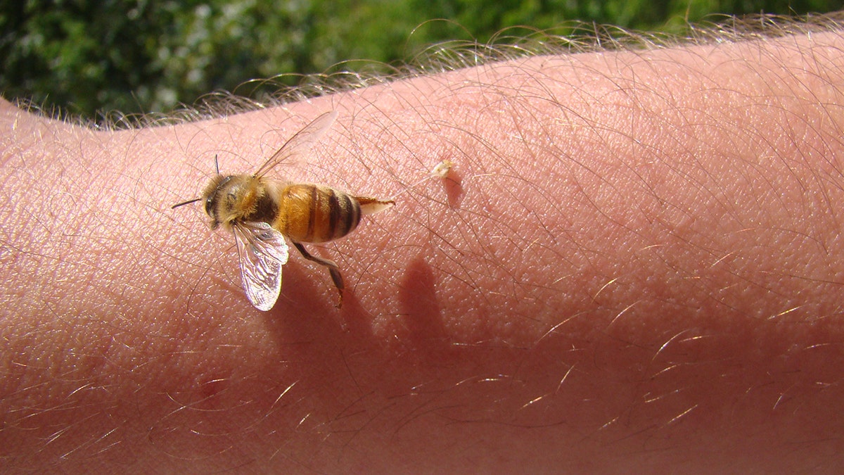 A bee that bites a human arm