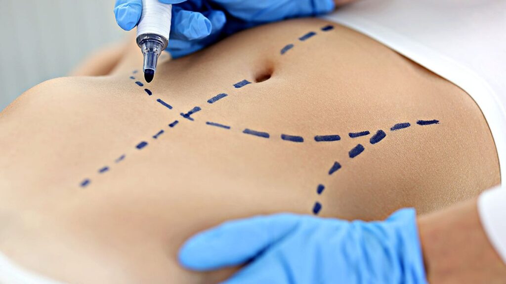 The main cosmetic procedures revealed in a new report: what is the tendency and why